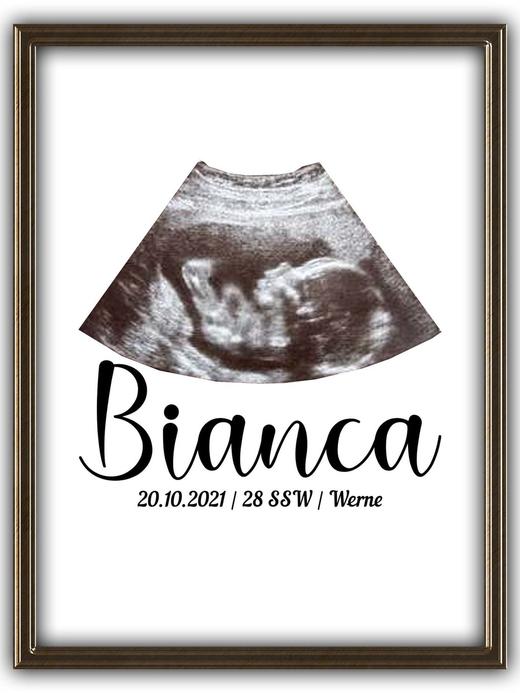 Poster mit ultraschall bild personalisiert thumb